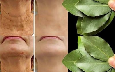 Är lagerblad 100 000 gånger starkare än Botox? | Naturlig rynkborttagare även vid 70 års ålder!