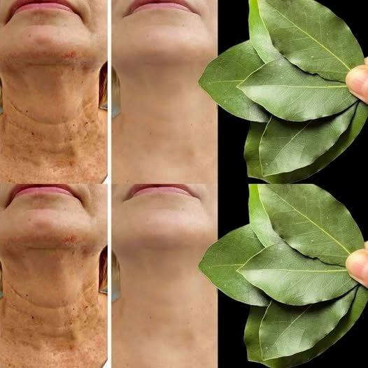 Är lagerblad 100 000 gånger starkare än Botox? | Naturlig rynkborttagare även vid 70 års ålder!