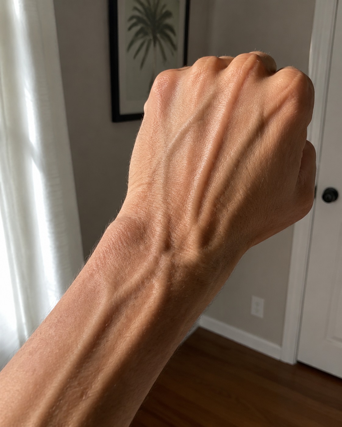 Om dina handvener är utbuktande eller mer synliga, ignorera inte dessa möjliga orsaker
