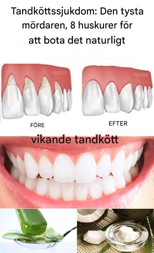 Tandköttssjukdom: Den tysta mördaren, 8 huskurer för att bota det naturligt