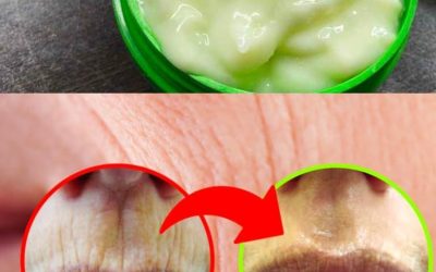 Hur man blir av med rynkor med en naturlig ingrediens: gurka