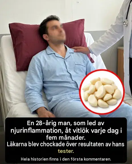 Att konsumera rå vitlök dagligen: vad det verkligen gör med din kropp (och det är förvånande)